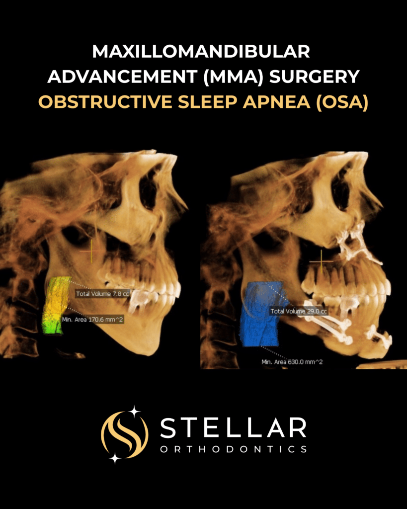 surgical before and after