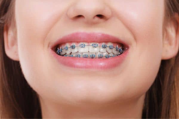 surgical orthodontics