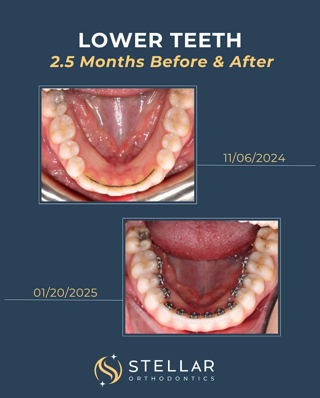 stellarortho_1746056328_3622505499151293359_58128957571