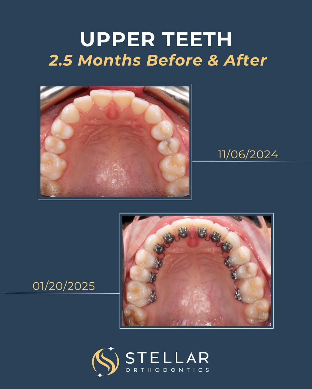 stellarortho_1746056328_3622505499344097248_58128957571