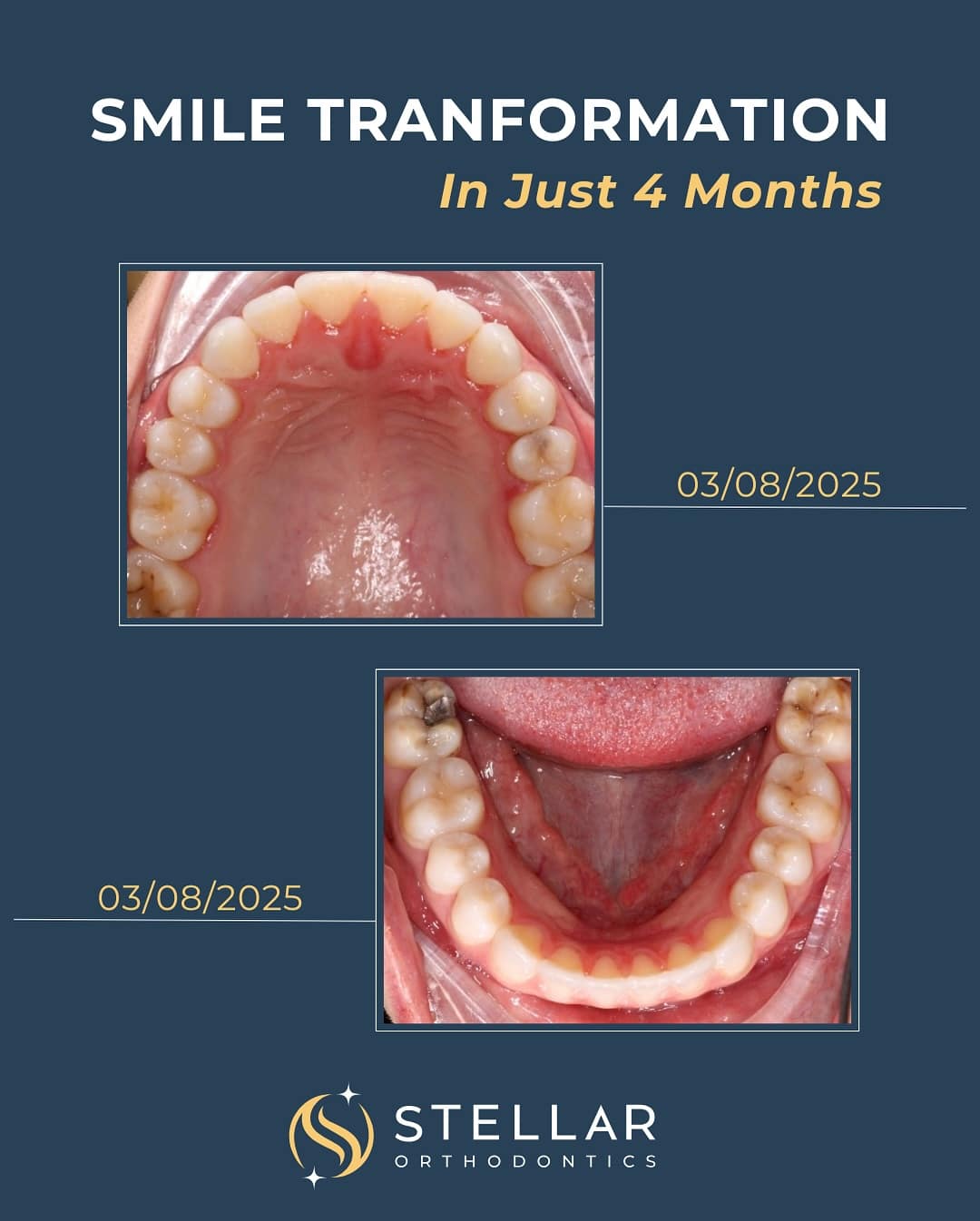 stellarortho_1746056328_3622505499453148168_58128957571